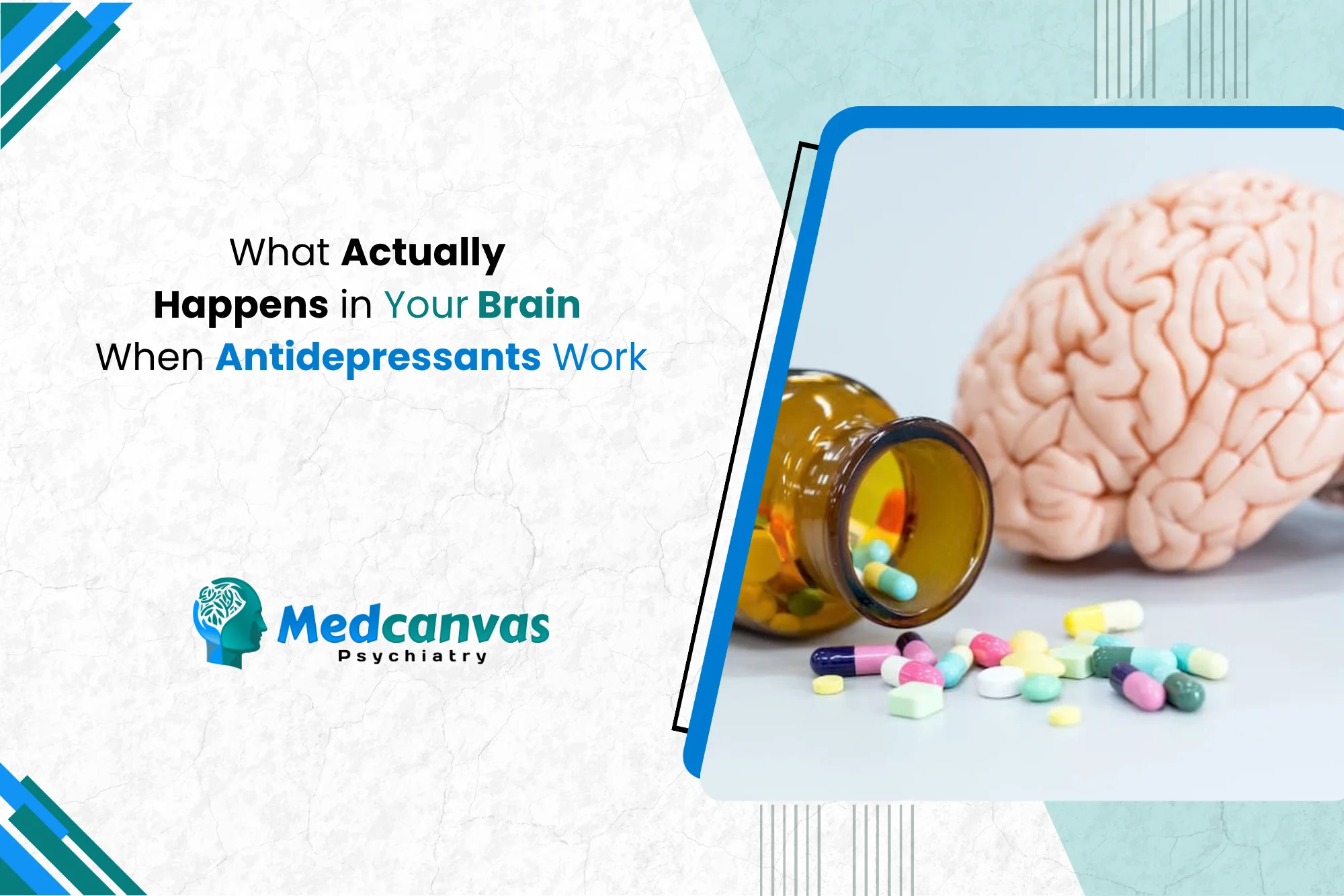 Actually Happens in Your Brain When Antidepressants Work